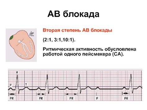 Ритмическая активность сердца