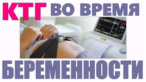 Роль кардиотокографии (КТГ) во время беременности