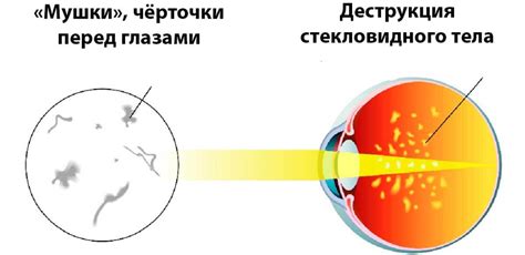 Роль питания в появлении плавания перед глазами