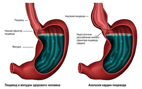 Роль пищевода и пищеводных сфинктеров