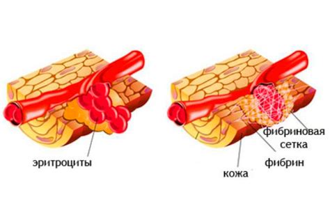 Роль фибриногена в системе иммунитета