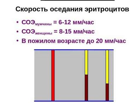 Симптомы дезорганизации корковой ритмики