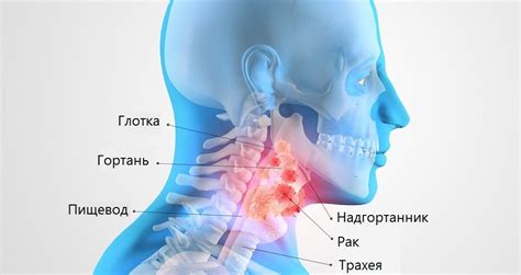 Симптомы заболевания горла: как справиться и что делать