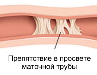 Симптомы и осложнения при непроходимости капель в ухе