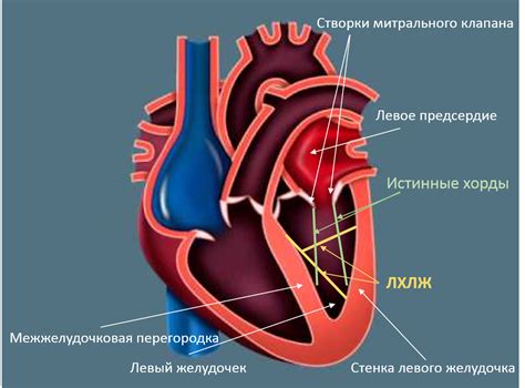 Симптомы и признаки ложной хорды левого желудочка