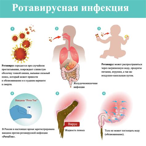 Симптомы и причины инфекции