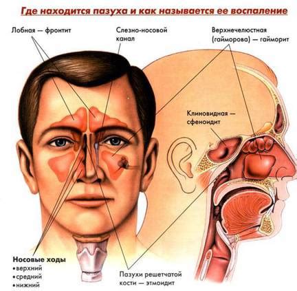 Симптомы катарального изменения придаточных пазух носа