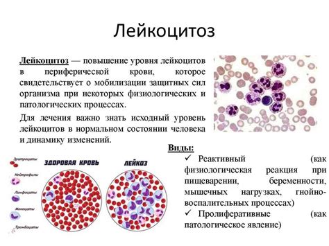 Симптомы лимфоцитоза у малышей