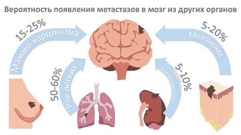 Симптомы метастазов при раке головного мозга