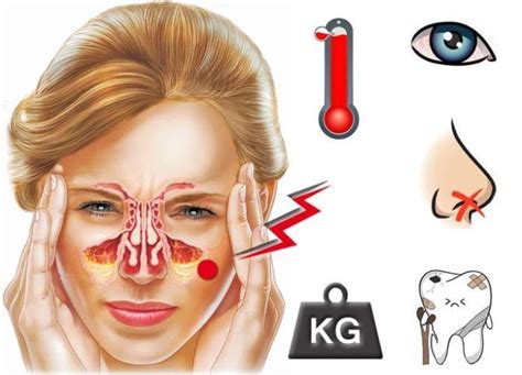 Симптомы наличия гноя в пазухе носа