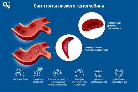 Симптомы низкого гемоглобина у женщин