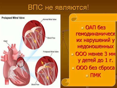 Симптомы открытого овального окна