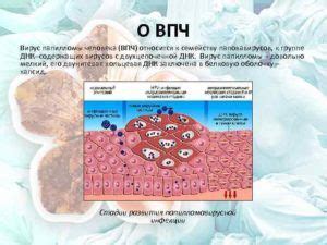 Симптомы папилломы 39 типа у женщин