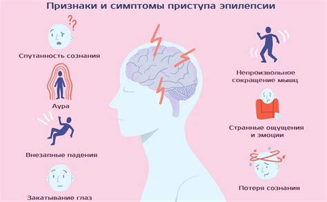 Симптомы приступа эпилепсии