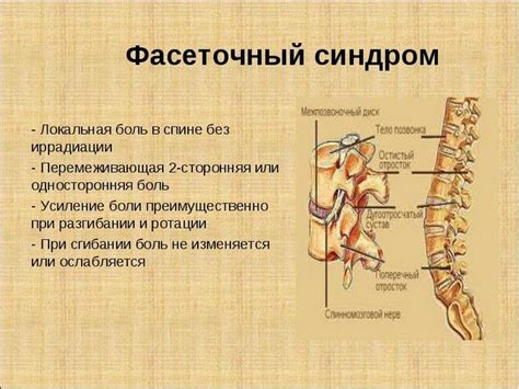 Симптомы фасеточного синдрома поясничного отдела