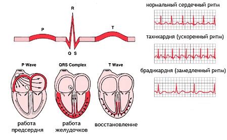 Синусовая аритмия у детей