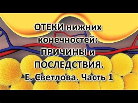 Снятие отечности