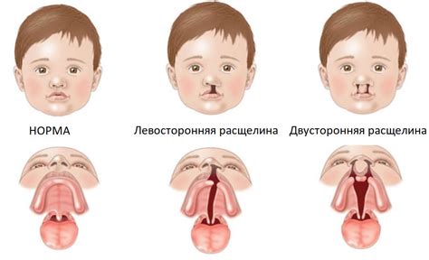 Современные методы лечения отека губы у ребенка