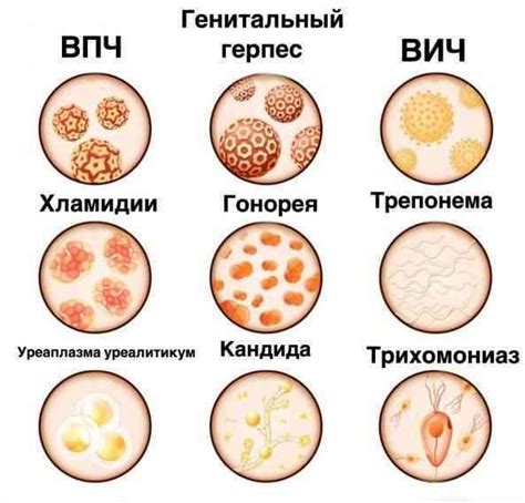 Способы предотвращения заражения