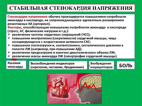 Стабильная стенокардия: понятие и проявления