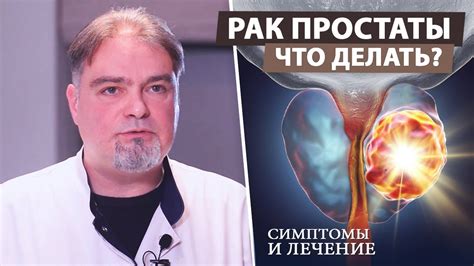 Структурные изменения предстательной железы: причины и симптомы