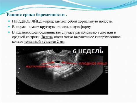 Структурные нарушения плаценты в ранние сроки беременности