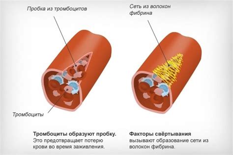 ТКР в крови и возможные причины повышения