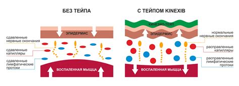 Тейпы: разновидности и применение