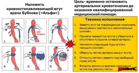 Техники быстрой наколки жгута зимой