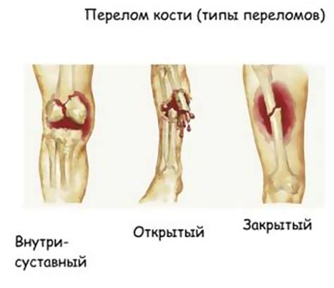 Травма и механические повреждения сосудов