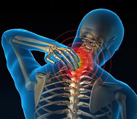 Травмы и перегрузки шейного отдела позвоночника