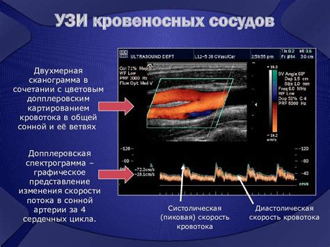 УзДГ: основные моменты