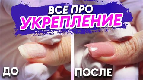 Укрепление ногтевой пластины