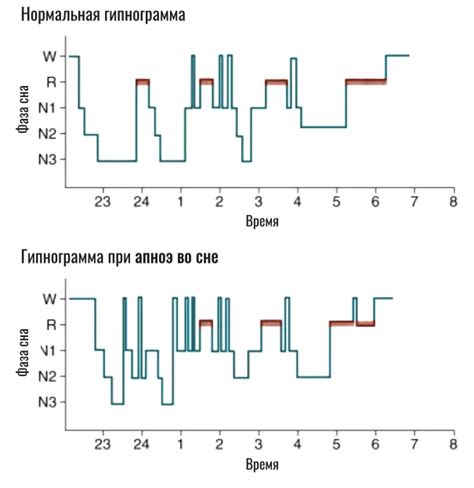 Установление регулярного расписания сна