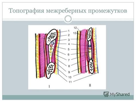 Утолщение межреберных промежутков