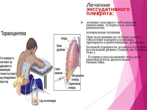 Факторы, вызывающие скопление жидкости в легких