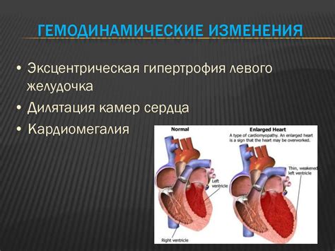 Факторы риска развития кардиомегалии у пожилых