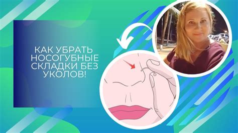 Филлер или нити - наиболее эффективные методы для коррекции носогубок