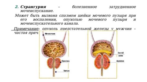 Частая мочеиспускание