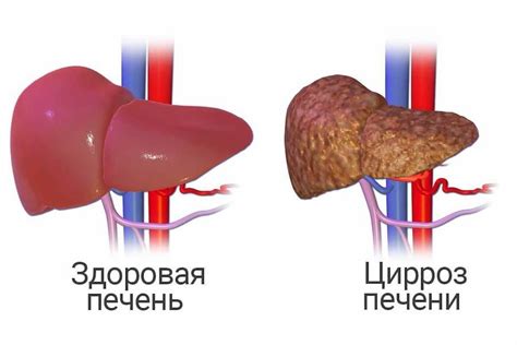 Что говорит о сниженном уровне креатинина в крови?