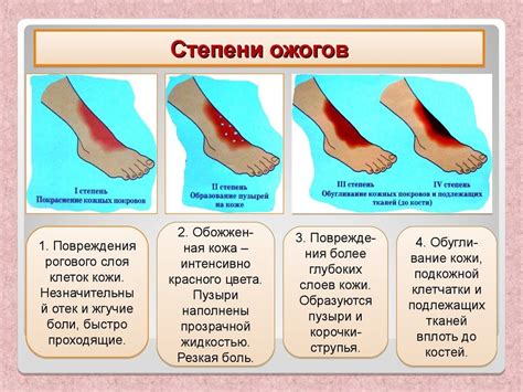 Что делать при ожоге воском: шаги к предотвращению осложнений