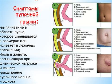 Что находится в окрестности пупочной впадины