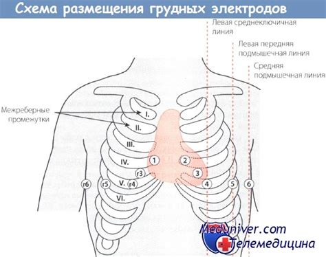 Что отображают отведения по межреберьям?