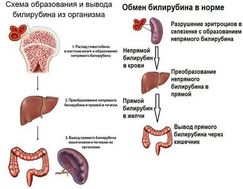 Что такое билирубин и когда он становится высоким?