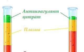 Что такое гематокрит и как его измеряют?