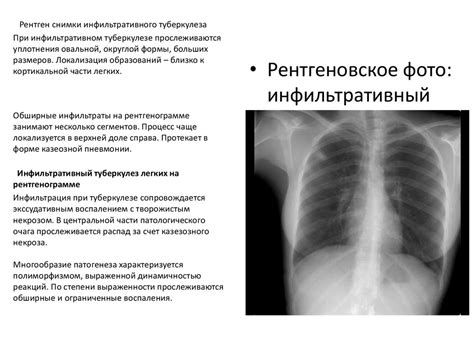 Что такое дегенеративные изменения глубоких легких?