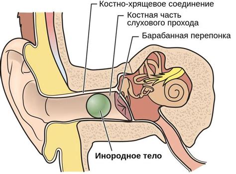 Что такое пищание в ухе?