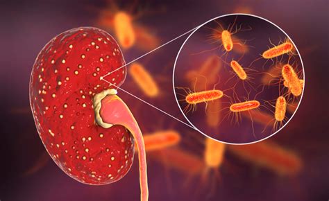 Что такое E. coli и как она попадает в мочевую систему?