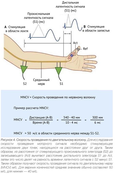 Электронейромиография верхних конечностей: основы и принципы